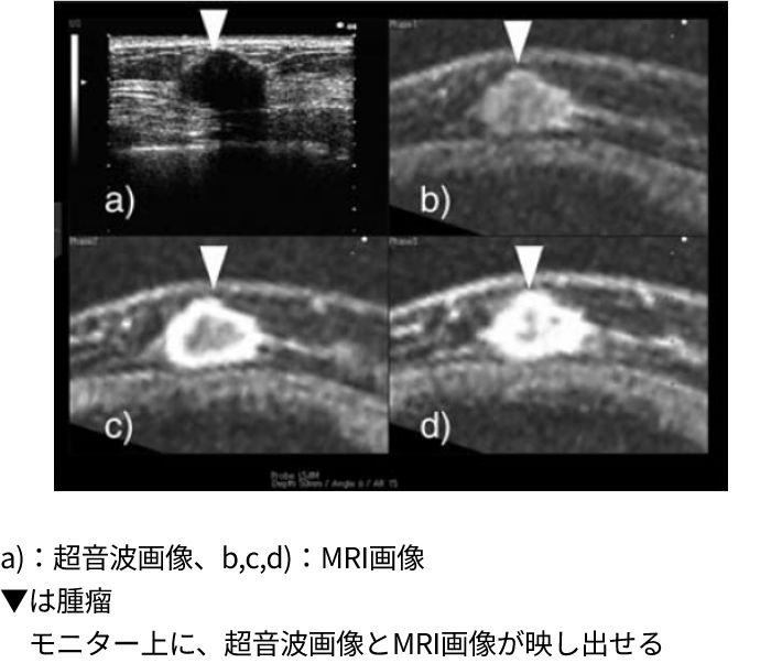 （図1）Real-time Virtual Sonography（RVS）のイメージ図