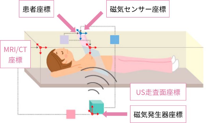 （図1）Real-time Virtual Sonography（RVS）のイメージ図