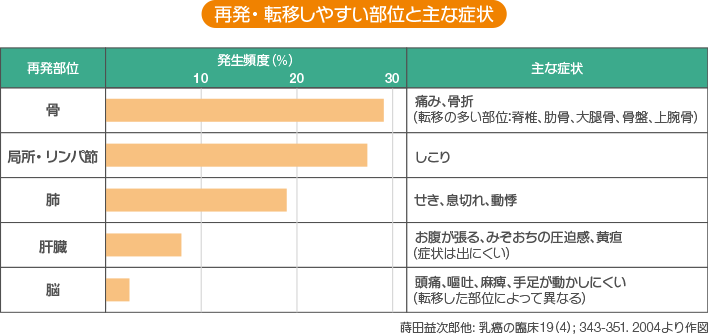 《再発・転移しやすい部位と主な症状》骨転移、発生率は約29％、症状は痛みや骨折。転移の多い部位は脊椎、肋骨、大腿骨、骨盤、上腕骨。局所・リンパ節、発生率は約15％、症状はしこり。肺転移、発生率は約19％、症状はせき、息切れ、動悸。肝転移、発生率は約8％、症状は出にくいが、お腹がはる、みぞおちの圧迫感、横断などがあらわれる。脳転移、発生率は約2％、症状は転移した部位によって異なるが、頭痛、嘔吐、麻痺、手足が動かしにくいなどの症状があらわれる。