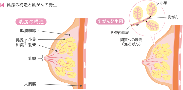 初期 症状 乳がん 乳がんの初期症状 しこりの感触や動き