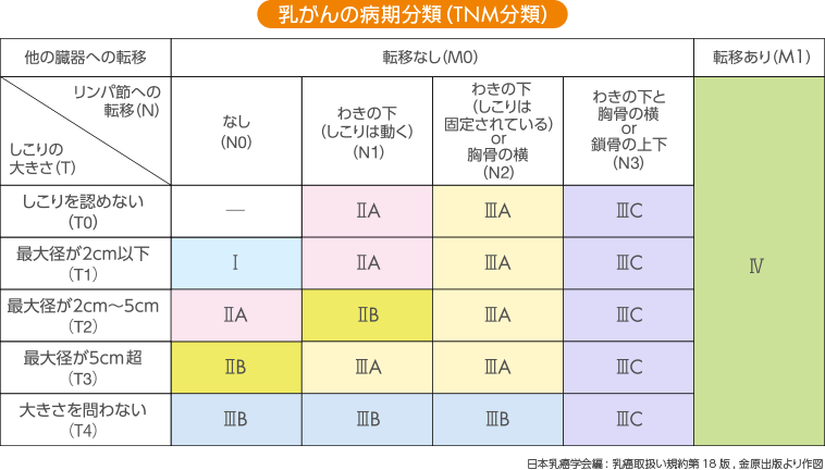 乳がんの病期分類（TNM分類）