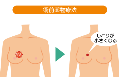 術前薬物療法